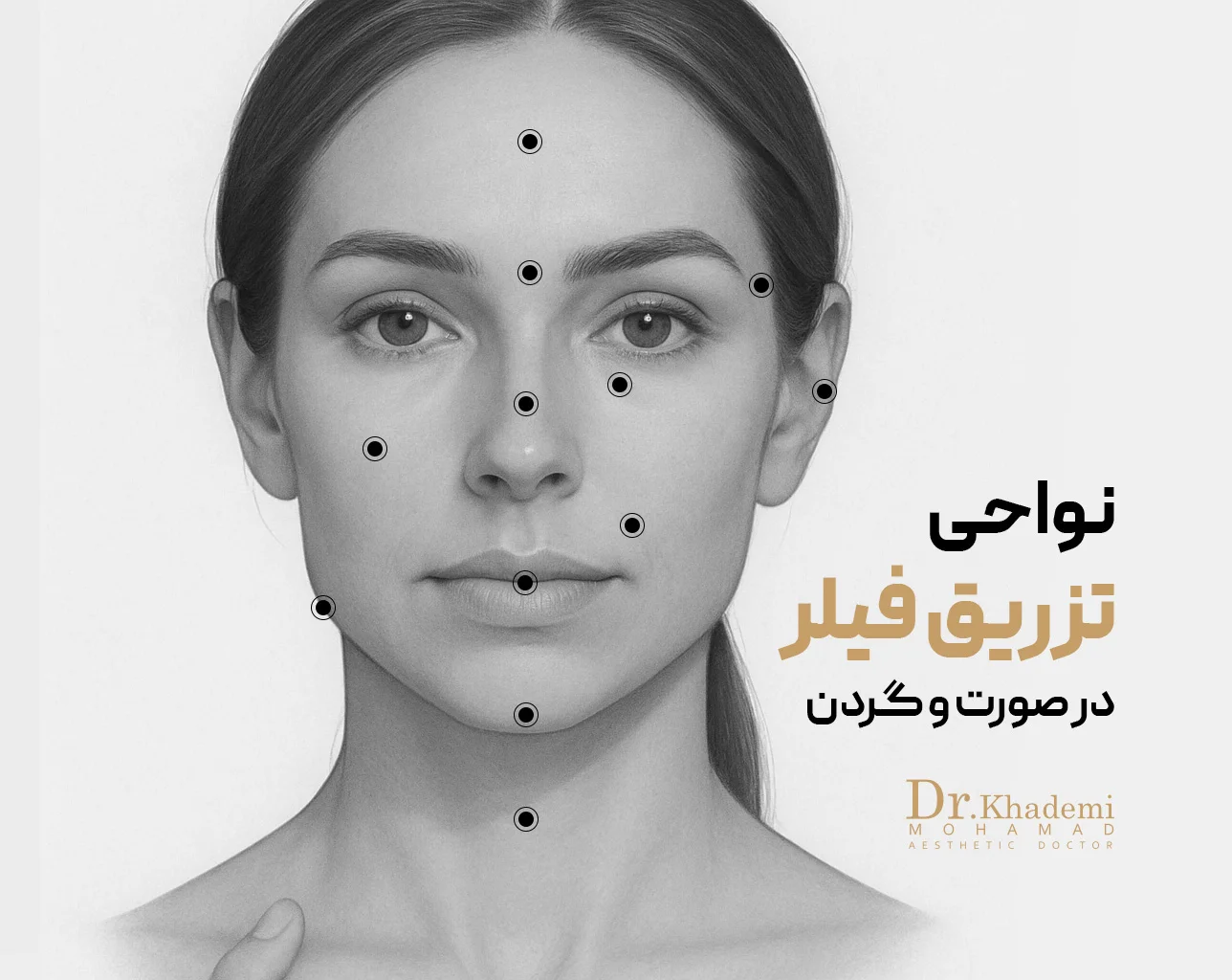 تصویر صورت یک خانم است که بر روی آن نواحی تزریق فیلر یه صورت و گردن با نقطه مشخص شده است