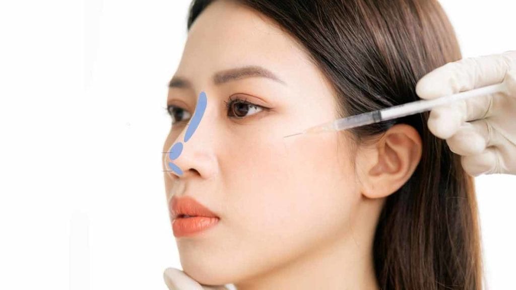 Nose filler in the north of Tehran