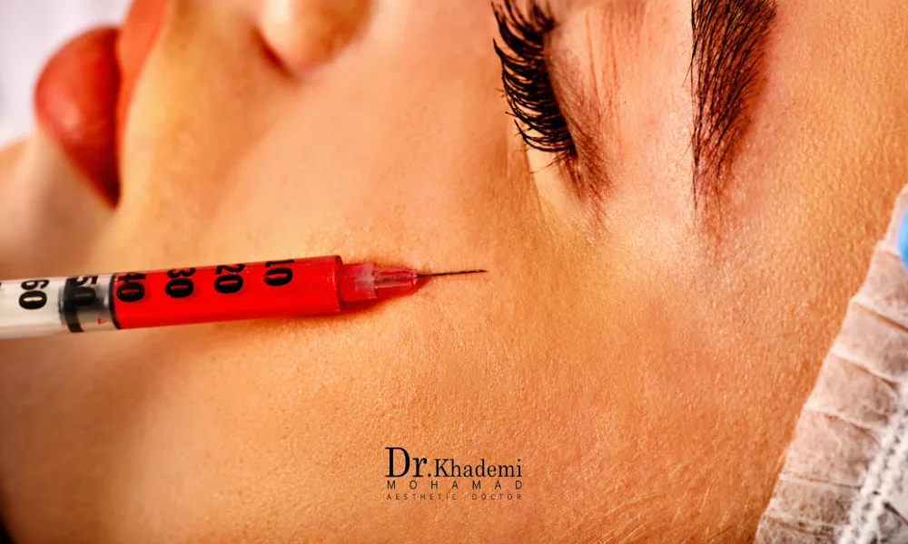 تزریق فیلر زیر چشم به متقاضی خانم | کوچک شدن چشم با فیلر