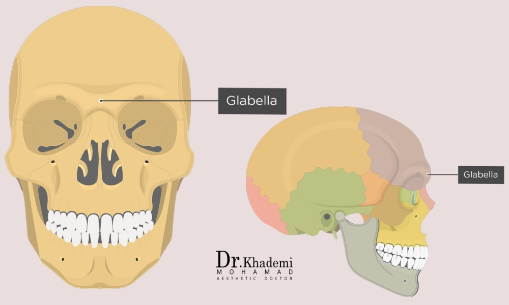 عکس گلابلا Glabella یا خط اخم | نقاط تزریق بوتاکس خط اخم