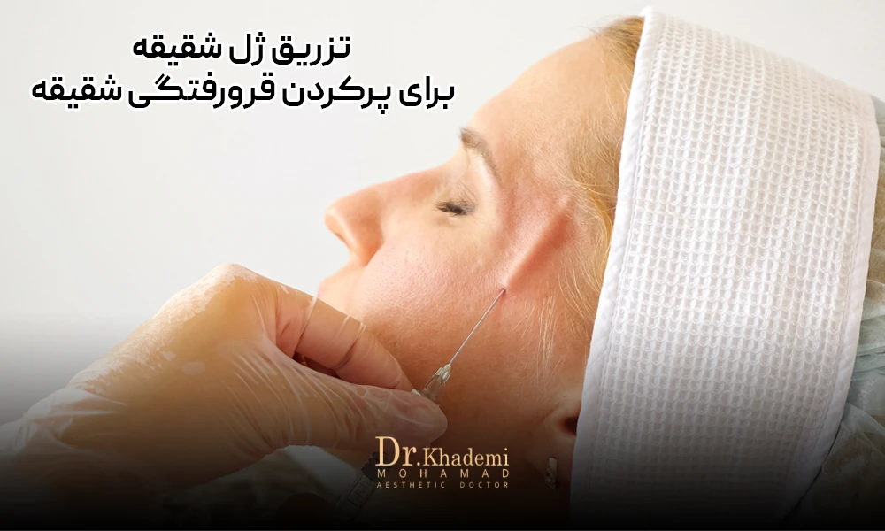 تصویر یک خانم است که کلاه پزشکی پوشیده و سوزنی که دکتر در قسمت شقیقه فرو کرده است.